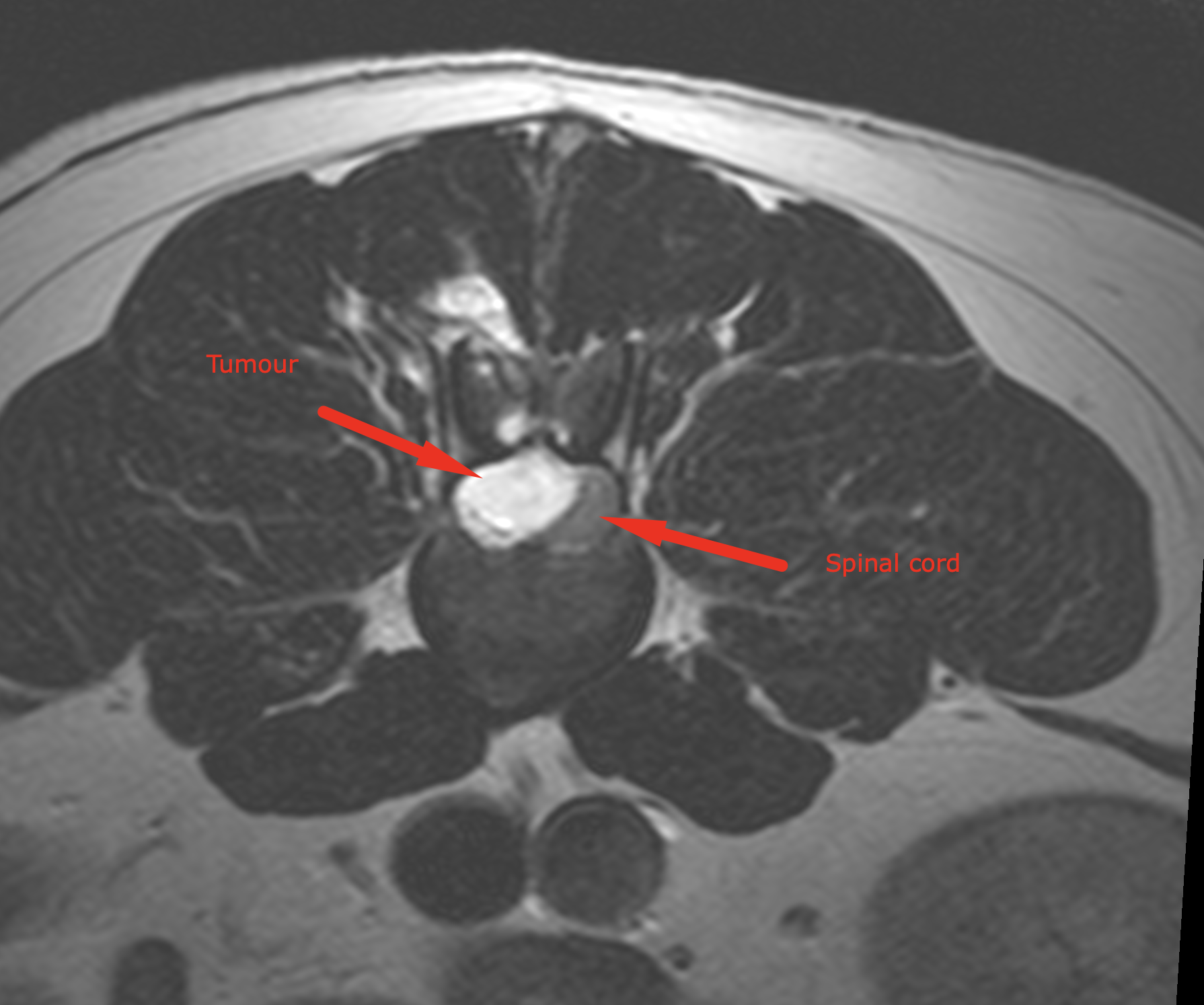 Riley and the MRI scan - Bridge Referrals